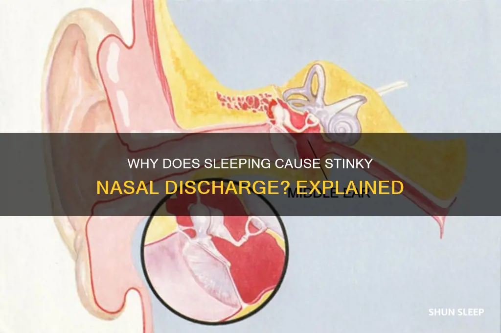 why get stink liquid from nose when sleeping