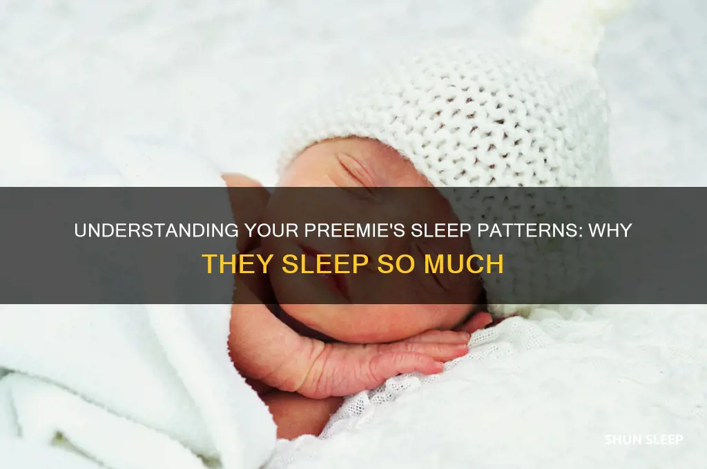why is my premature baby always sleeping