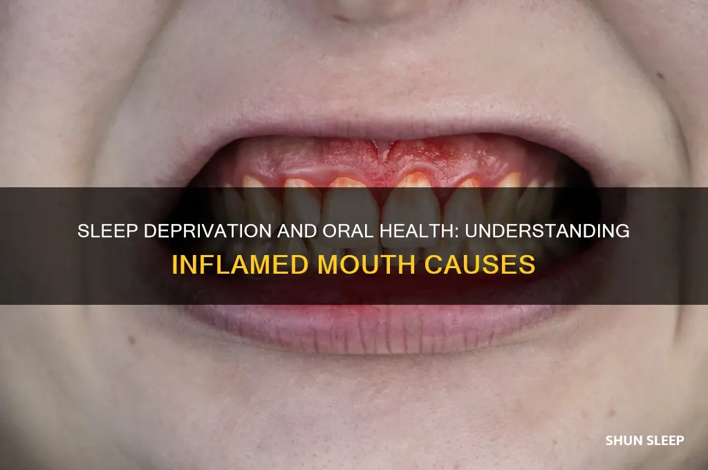 why mouth gets inflamed lack of sleep