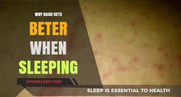 Sleep's Healing Power: How Rest Soothes and Repairs Skin Rashes