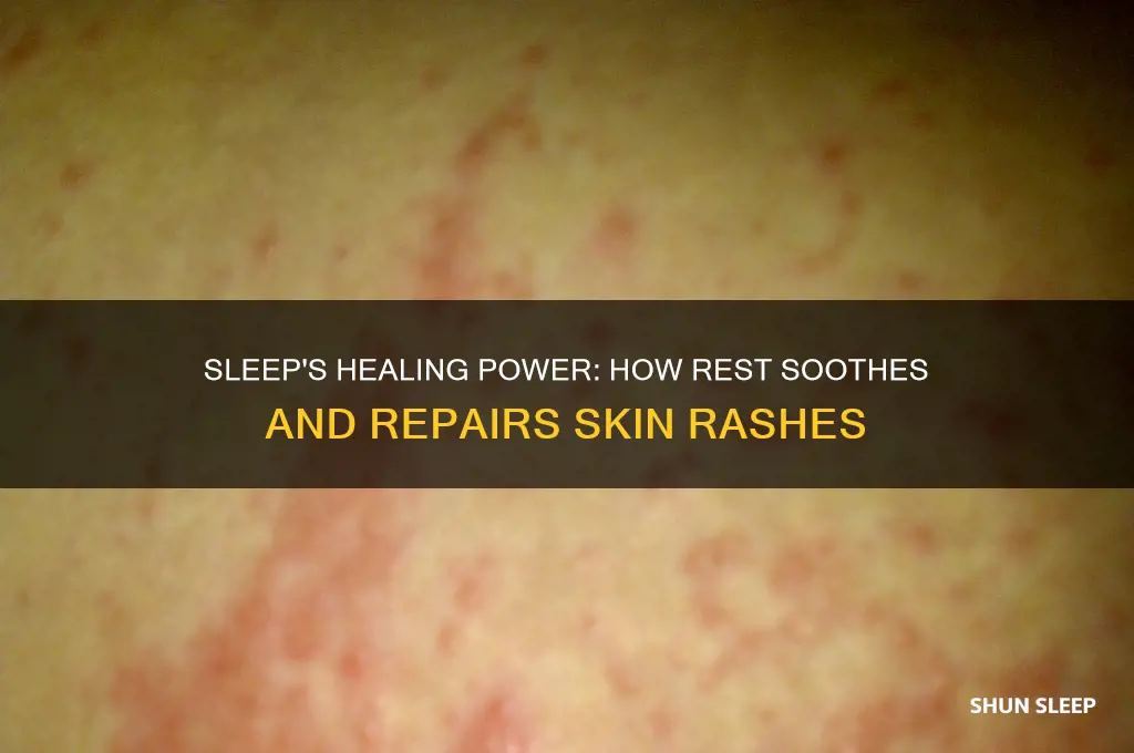 why rash gets beter when sleeping