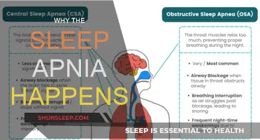 Understanding Sleep Apnea: Causes and Triggers