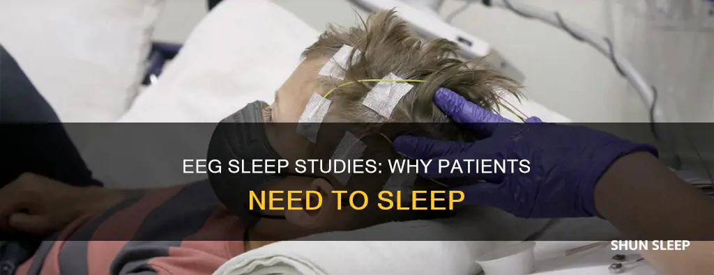 why would a patient need to sleep during an eeg