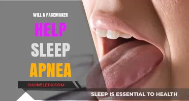 Can a Pacemaker Improve Sleep Apnea Symptoms? Exploring the Connection