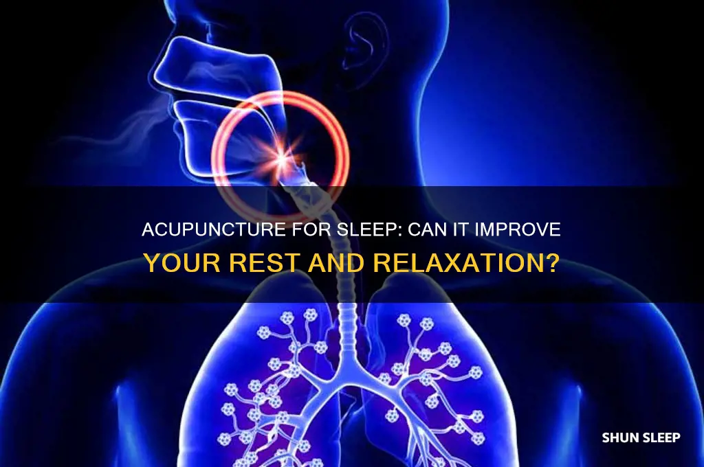 will acupuncture help with sleep problems