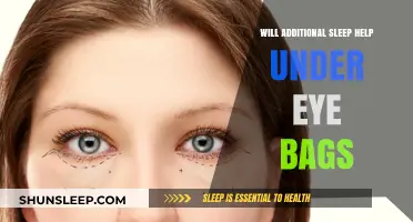 Can Extra Sleep Reduce Under-Eye Bags? Uncovering the Truth