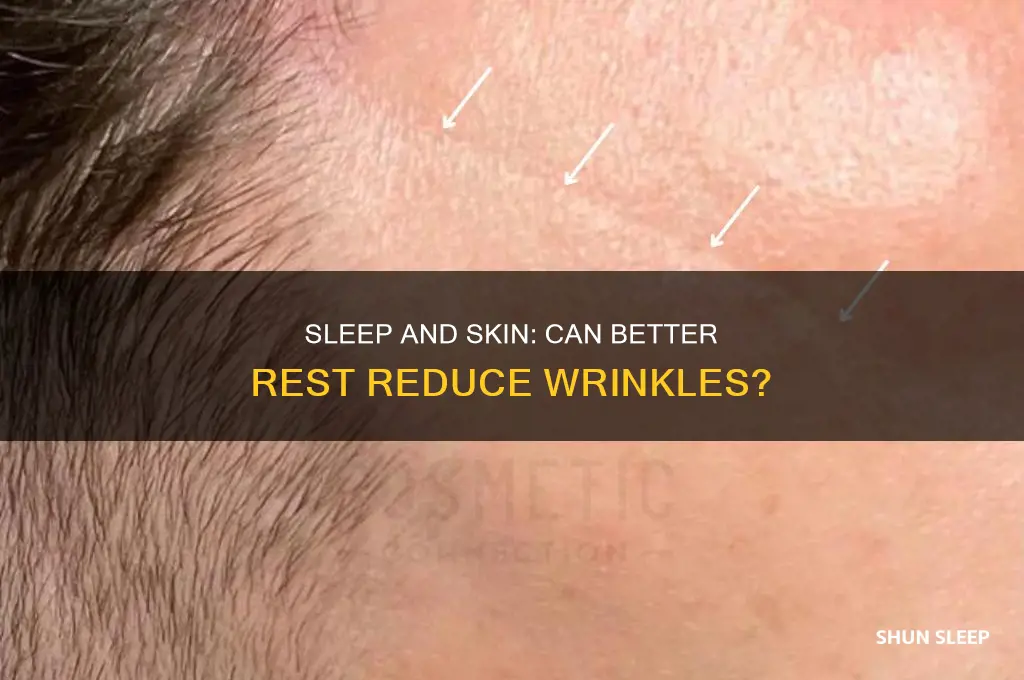will better sleep help my wrinkles