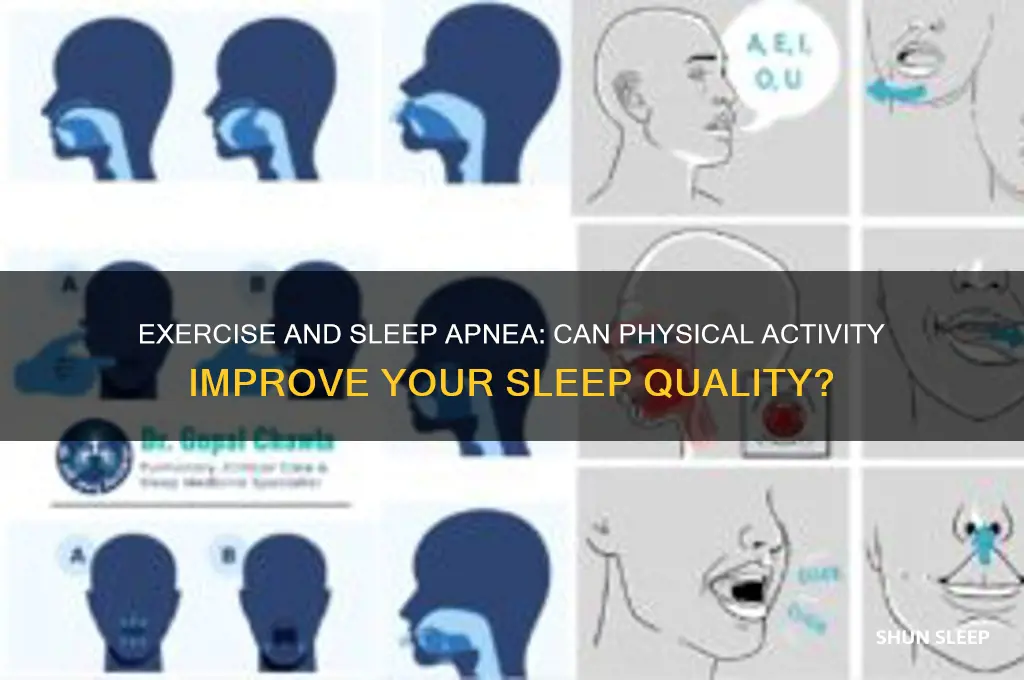 will exercise help sleep apnea