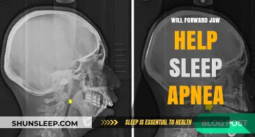 Forward Jaw Positioning: A Potential Sleep Apnea Treatment Solution?