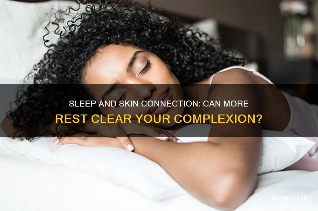 will getting more sleep clear my skin