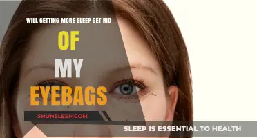 Can Extra Sleep Banish Eye Bags? Uncovering the Truth Behind Dark Circles