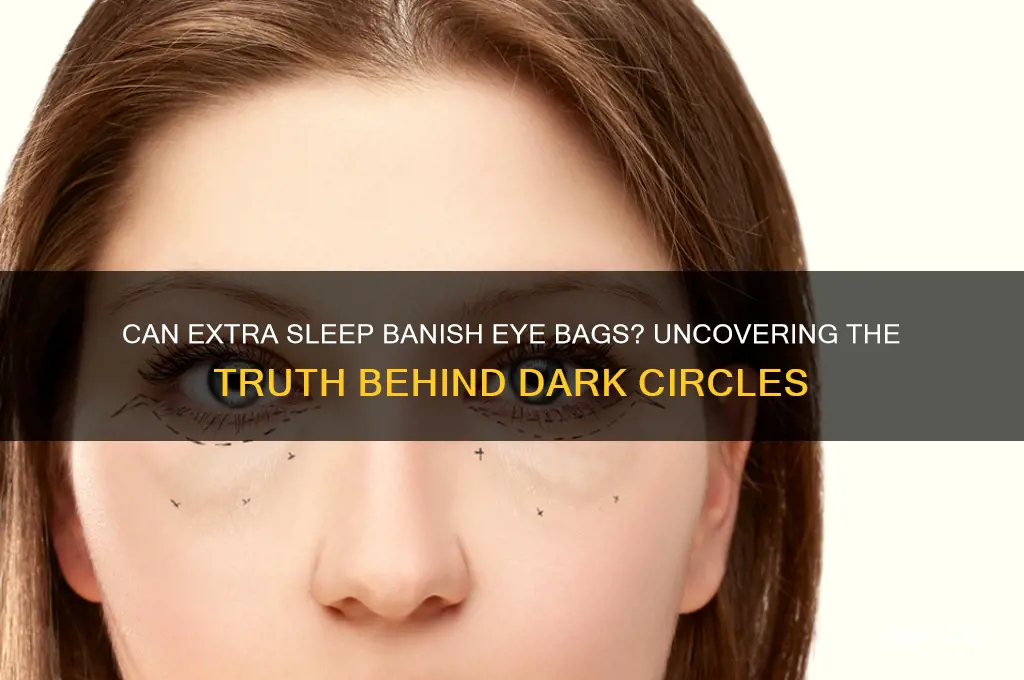 will getting more sleep get rid of my eyebags