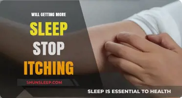 Can Extra Sleep Relieve Itching? Exploring the Sleep-Skin Connection