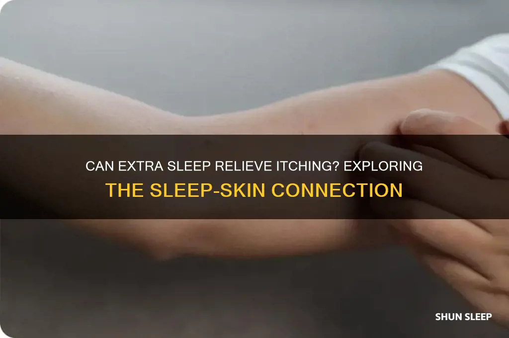 will getting more sleep stop itching