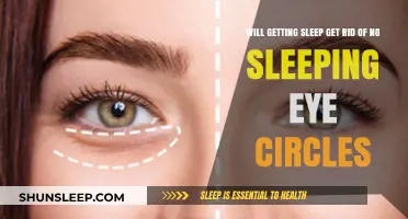 Can Quality Sleep Banish Those Stubborn Dark Eye Circles?