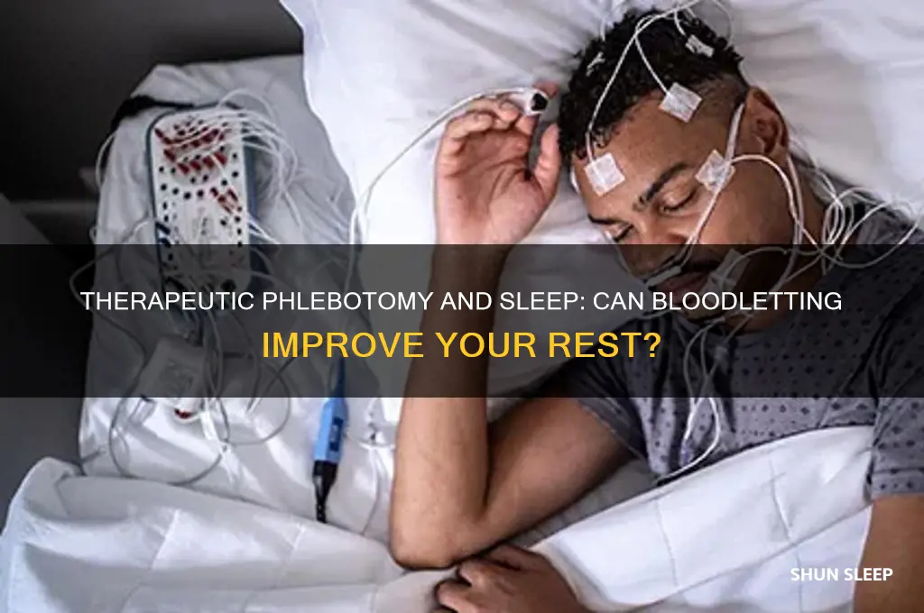 will having a theraputic phlebotomy help me sleep