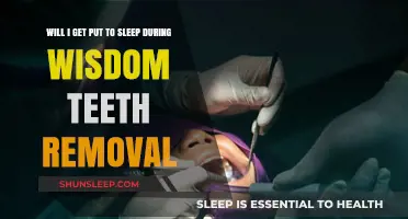 Wisdom Teeth Removal: Will You Be Asleep During the Procedure?