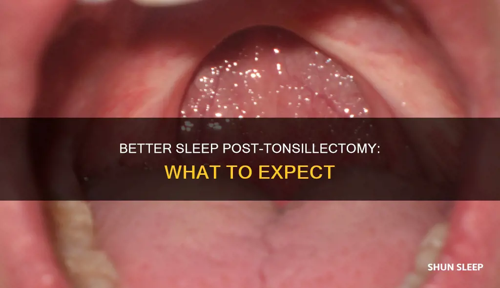 will i sleep better after a tonsillectomy