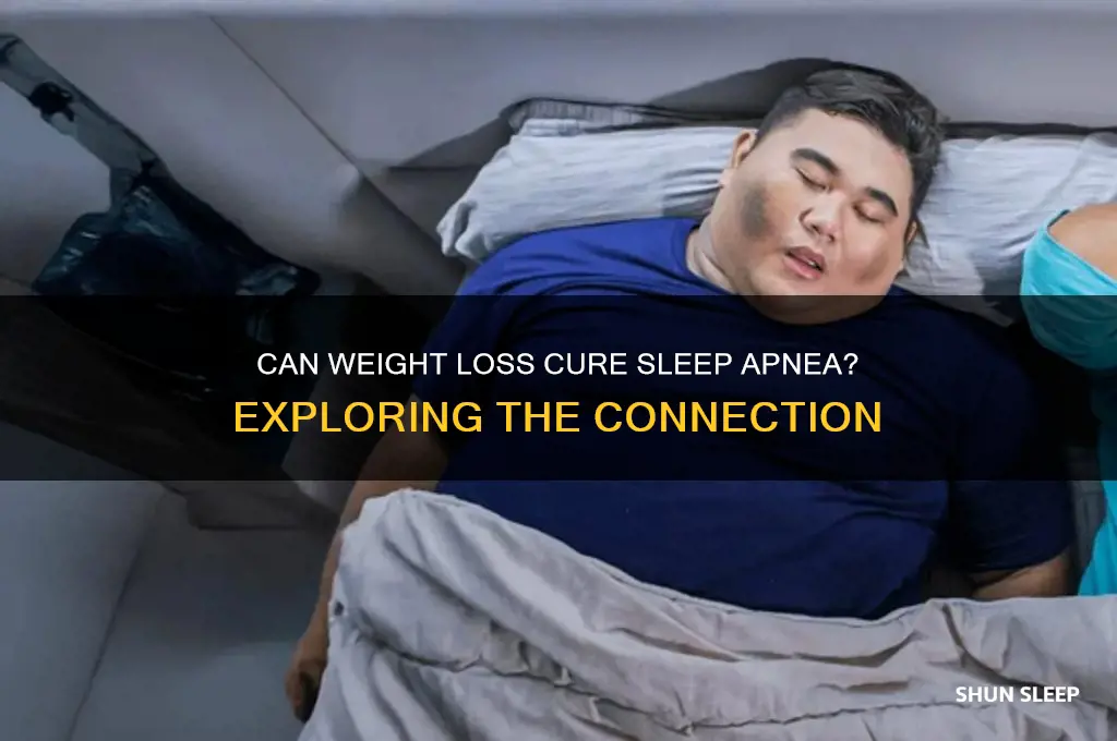 will losing weight get rid of my sleep apnea