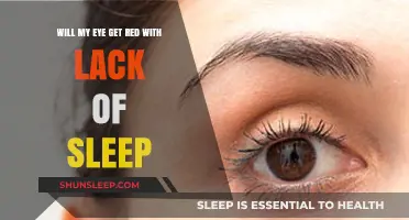 Lack of Sleep and Red Eyes: Understanding the Connection