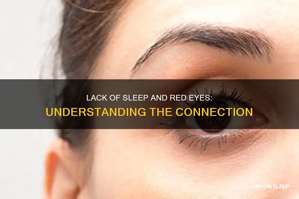 will my eye get red with lack of sleep