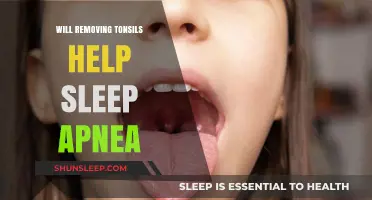 Can Tonsil Removal Improve Sleep Apnea Symptoms? Exploring the Link
