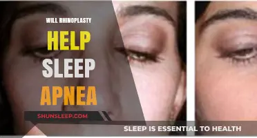 Rhinoplasty and Sleep Apnea: Can Nose Surgery Improve Breathing?