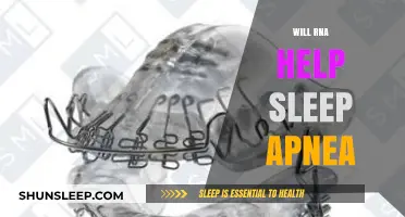 RNA Therapy: A Potential Breakthrough for Sleep Apnea Treatment?