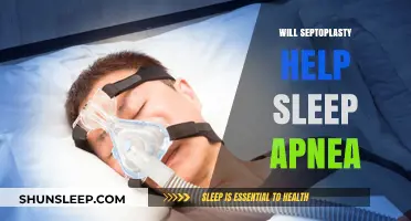 Septoplasty and Sleep Apnea: Can Nasal Surgery Improve Breathing?