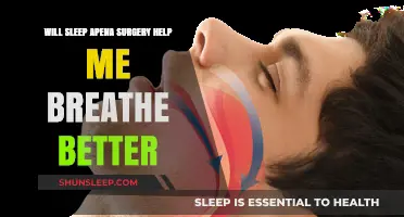 Can Sleep Apnea Surgery Improve Breathing and Quality of Life?