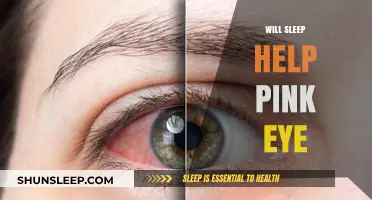 Can Sleep Aid Pink Eye Recovery? Uncover the Healing Connection