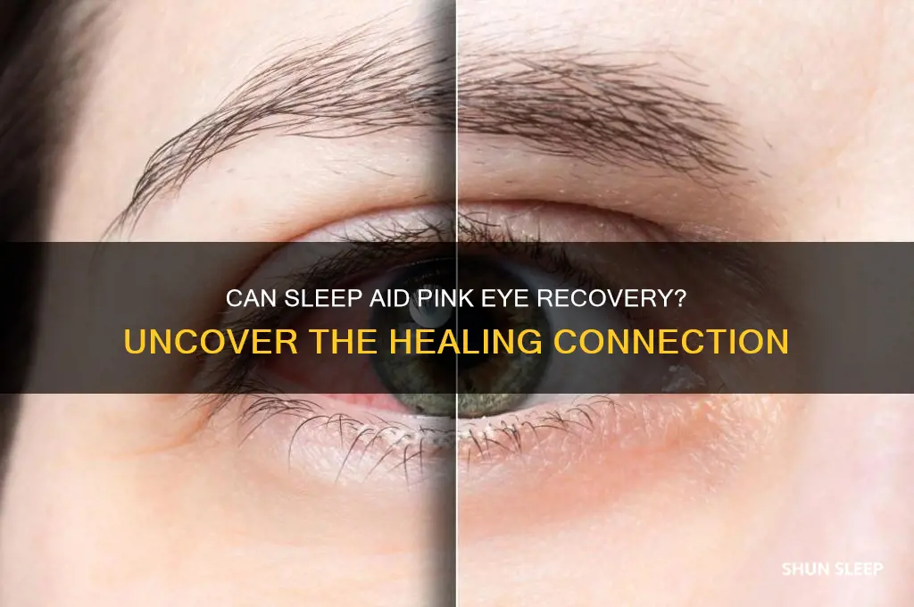 will sleep help pink eye