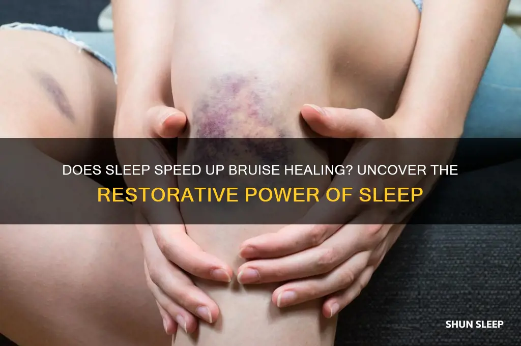 will sleeping help heal bruises