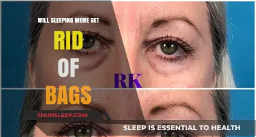 Can Extra Sleep Banish Under-Eye Bags? The Truth Revealed