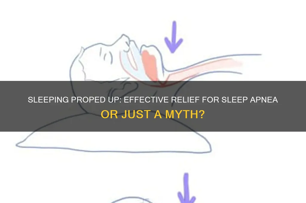 will sleeping proped help sleep apnea