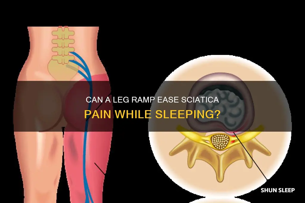 will sleeping with a leg ramp help sciatica