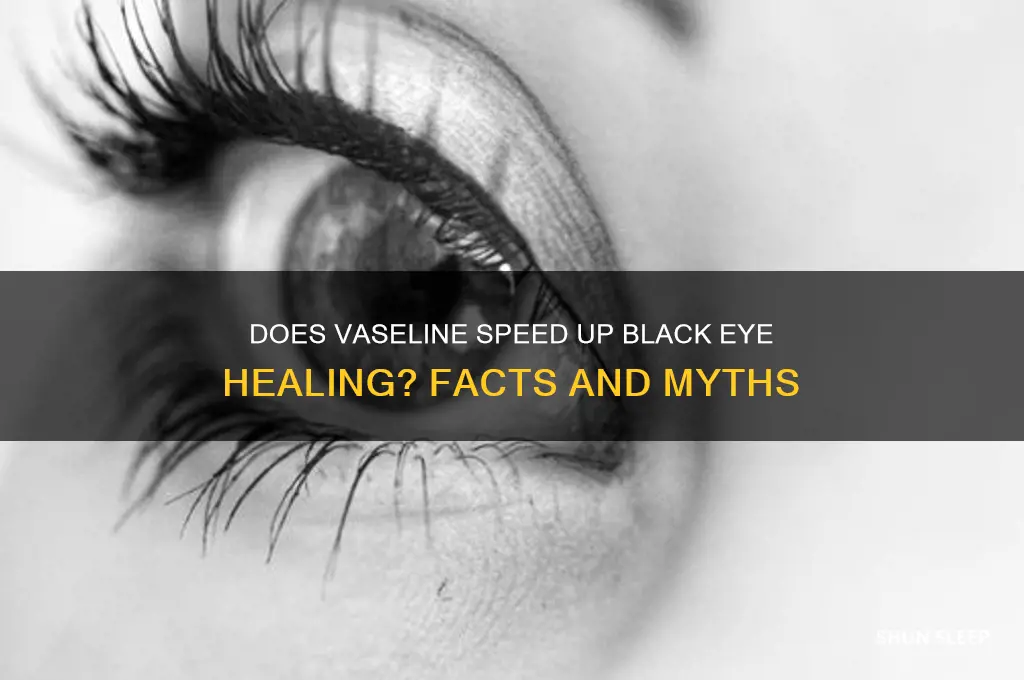 will sleeping with vaseline on a black eye help