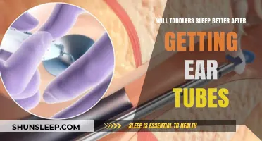 Ear Tubes and Toddler Sleep: Can They Improve Rest?