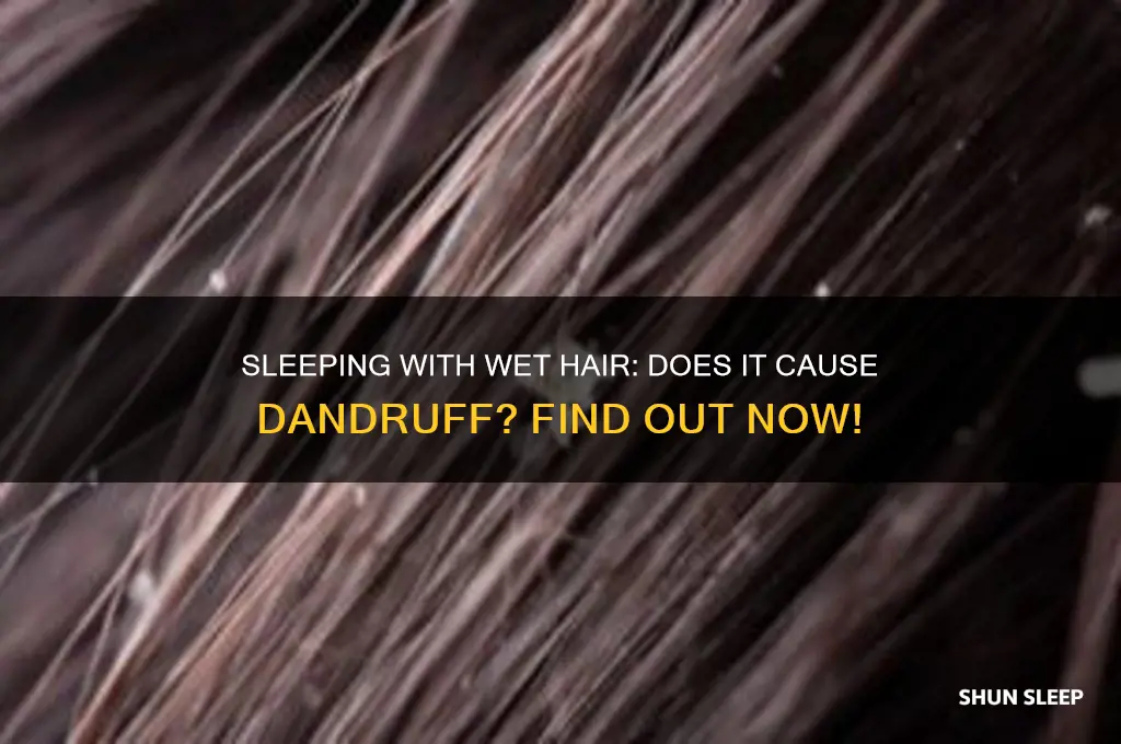 will u get dandruff if you sleep withwet hair
