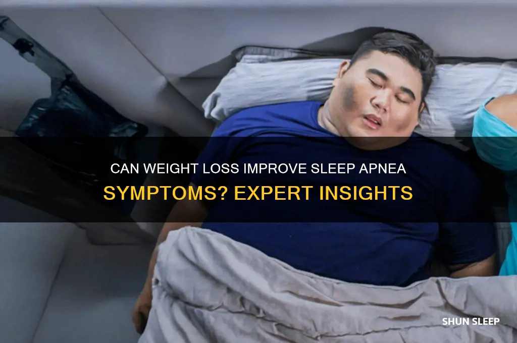 will weight loss help sleep apnea