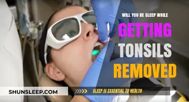 Will You Sleep During Tonsil Removal Surgery? What to Expect
