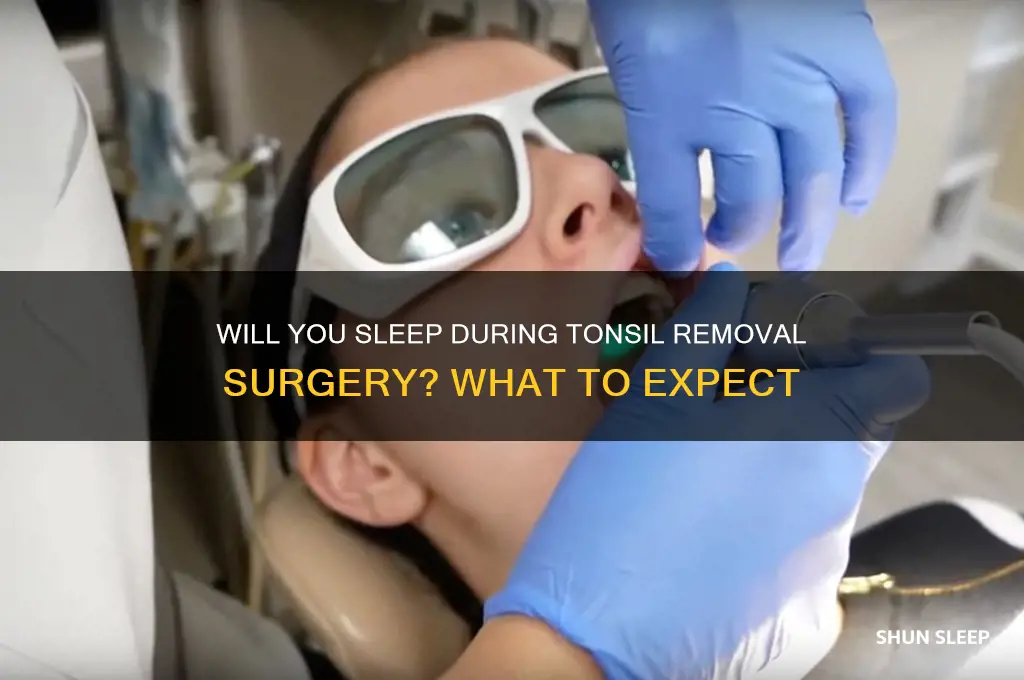 will you be sleep while getting tonsils removed