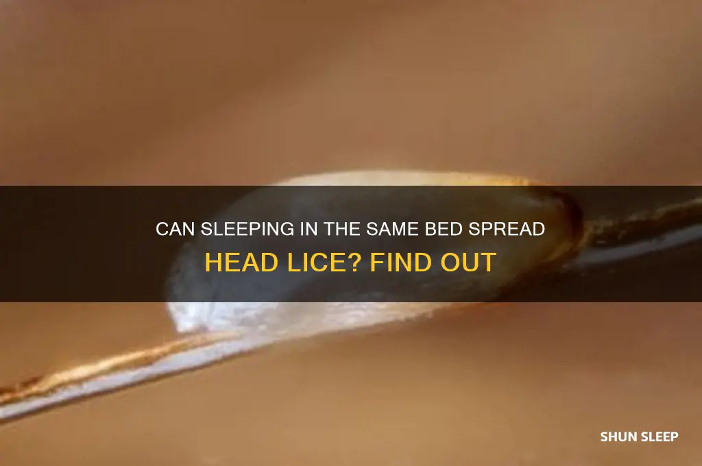 will you get headlice sleeping in bed with someone