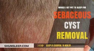 Sebaceous Cyst Removal: Understanding Anesthesia Options and Procedures