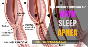 Can Esophageal Stretching Improve Sleep Apnea Symptoms? Exploring the Link